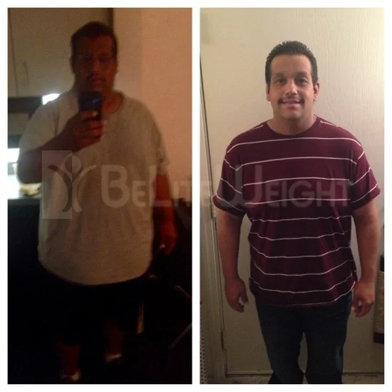 Weight Loss Surgery before and after Man - Anthony wanted to share his progress so far. He's down 80 pounds in just 4...
