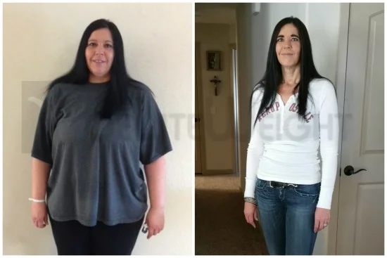 Weight Loss Surgery before and after Patient - Hi JoAnne,I was wondering if I can update the picture that we used for my...