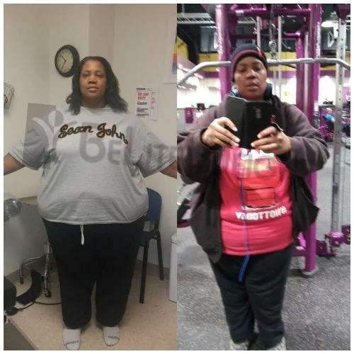 Weight Loss Surgery before and after Patient - Before and after 8 months out...close to 100 lbs. Surgeon Dr. Jose Rodriguez and Elmo AramburoProcedure...