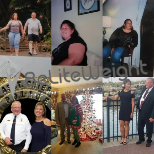 Weight Loss Surgery Before And After