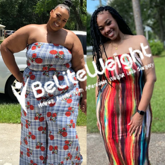 Gastric Sleeve before and after Patient - My weight loss has been going good. I have slowed down some but still maintain...