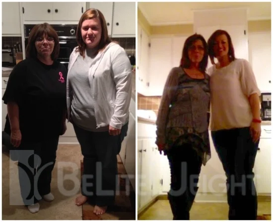 Weight Loss Surgery before and after Woman - Ishi,This is Denise W. (on the left) and my Daughter in Law, Ashley W. (on...