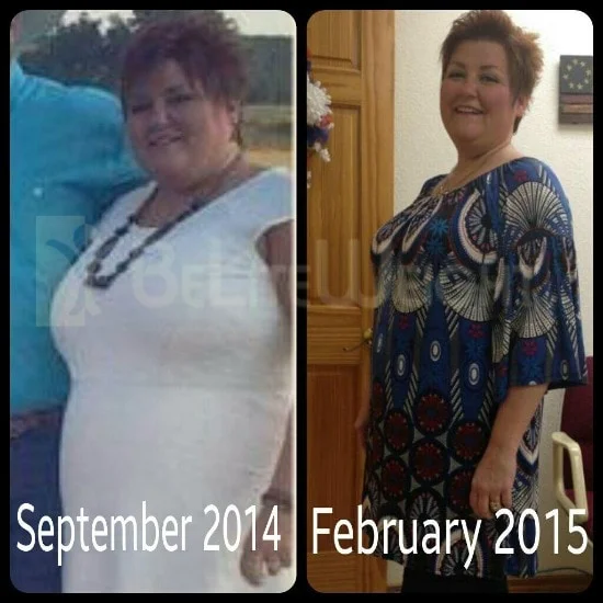 Weight Loss Surgery before and after Woman - Quanna is down 70 pounds in 4 months* after her Gastric Sleeve surgery in October....