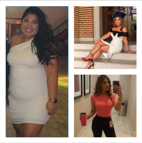RNY Gastric Bypass before and after Patient - I just want to say how amazing my experience with BeLightweight has been!I&rsquo;m officially 100lbs...