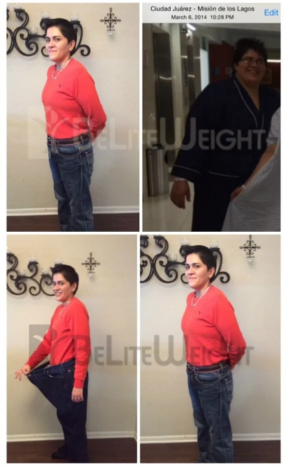 Weight Loss Surgery before and after Woman - Marisa was a size 50x32 now she is a size 32x32* one year after her...
