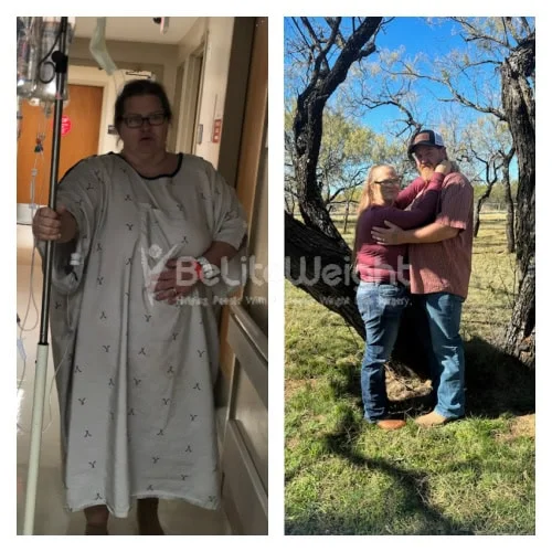 RNY Gastric Bypass before and after Man - Yes I am glad yesterday was one year I am down 137lbs and from 44...