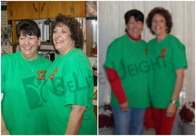 Wendy - Before and After Weight Loss Surgery