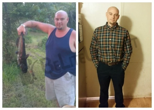 Joe - Before and After Weight Loss Surgery