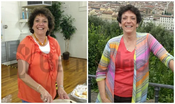 Wendy - One Year After Weight Loss Surgery