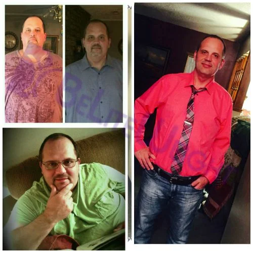 Weight Loss Surgery before and after Patient - Forgot to tell you the total weight loss after 11 months was :   155...