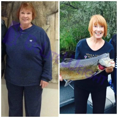 Weight Loss Surgery before and after Patient -  I am doing GREAT!!! My surgery was the end of December 2014 and in the...