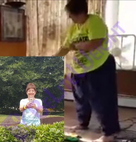 weight loss surgery vsg vertical gastric sleeve bypass mini bariatric laproscopic weight loss surger