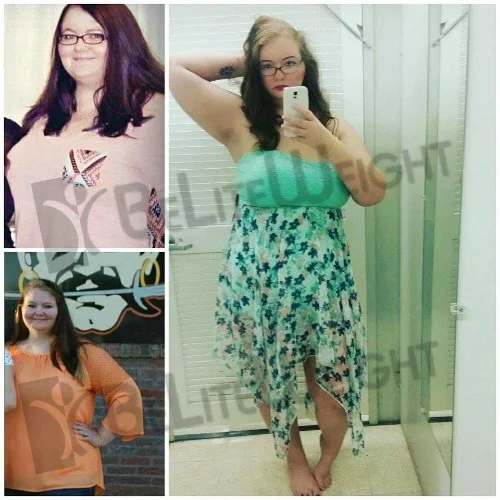 weight loss surgery bariatric gastric before after bypass sleeve mini