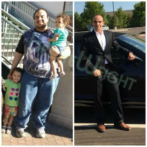 Weight Loss Surgery before and after Patient - This journey was not easy to be taken as it took me 2 years to...