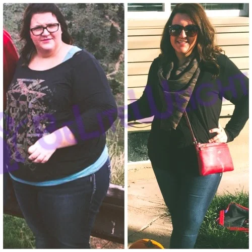 gastric bypass vsg surgery weight loss