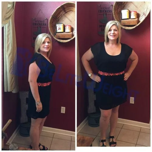 Weight Loss Surgery before and after Patient - Hi! I am six months post op now! I am down 72 pounds!!! I can now...