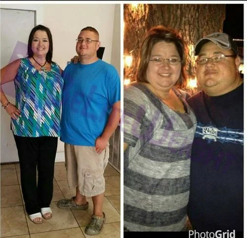 Weight Loss Surgery before and after Man - Well, we have officially reached 200 lbs lost between the 2 of us. I had...