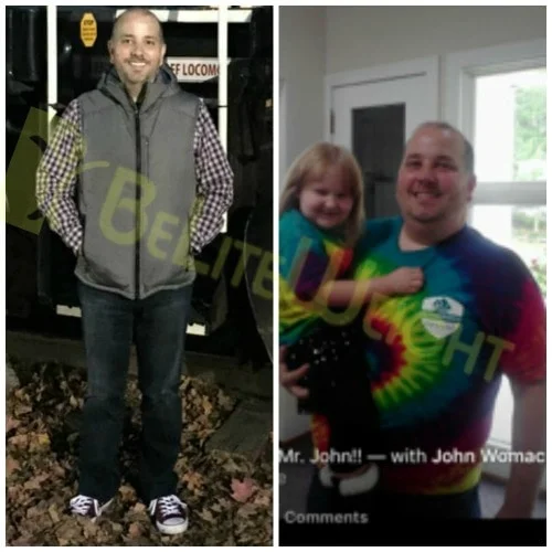 weight loss surgery vsg gastric sleeve before after photos testimonial