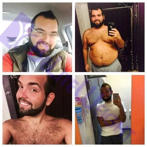 Weight Loss Surgery before and after Patient - just wanted to say thanks. And I'm doing great.  My starting weight was 316. Now...