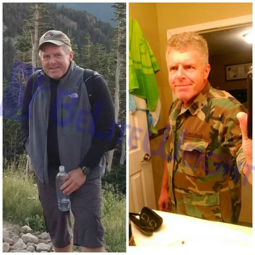 Weight Loss Surgery before and after Patient - down 83 lbs, my old Army uniform now fits again, and I climbed Long’s Peak...