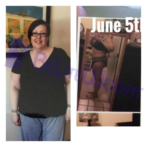 Weight Loss Surgery before and after Patient - I just have to say how happy I am that I went through this journey....