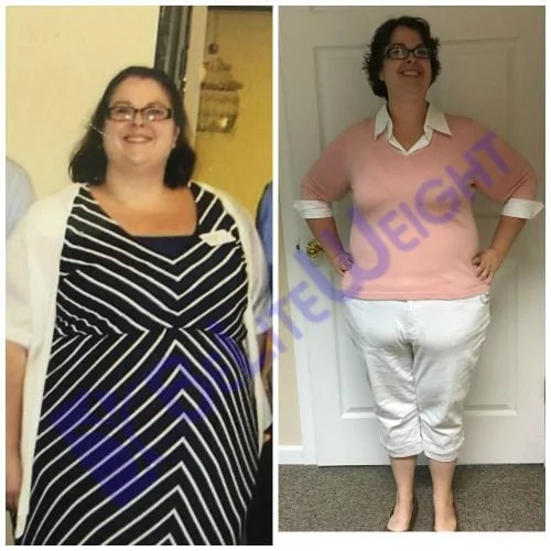 Weight Loss Surgery before and after Patient - This was the best decision I have ever made. The biggest thing that I have...