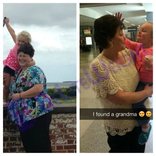 Weight Loss Surgery before and after Patient - Down 96 pounds! Thank you for making this possible for me!!!* Surgeons Dr Jose Rodriguez and...