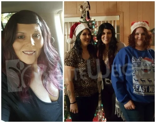 Weight Loss Surgery before and after Patient -  Appreciate you all and the great job your team does for those of us that...