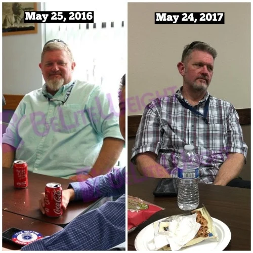 weight loss surgery vsg vertical gastric before and after