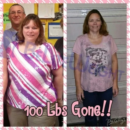 vsg gastric sleeve weight loss before and after surgery