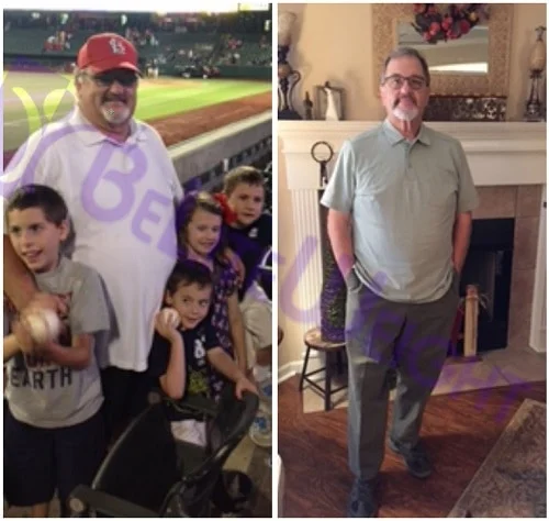 Weight Loss Surgery before and after Man - "My Journey.My journey started in May of 2016. My doctor had told me that if...