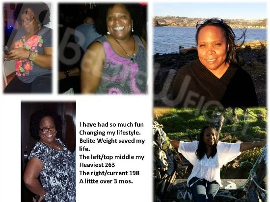 Weight Loss Surgery before and after Patient - Robin's down 65 pounds in 3 months* and wanted to share an updated collage. Thank...