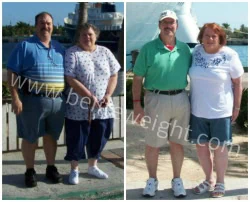 Vertical Sleeve Gastrectomy - VSG Success Stories