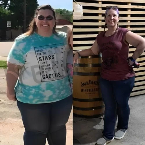 Gastric Bypass Revision Patient Testimonials