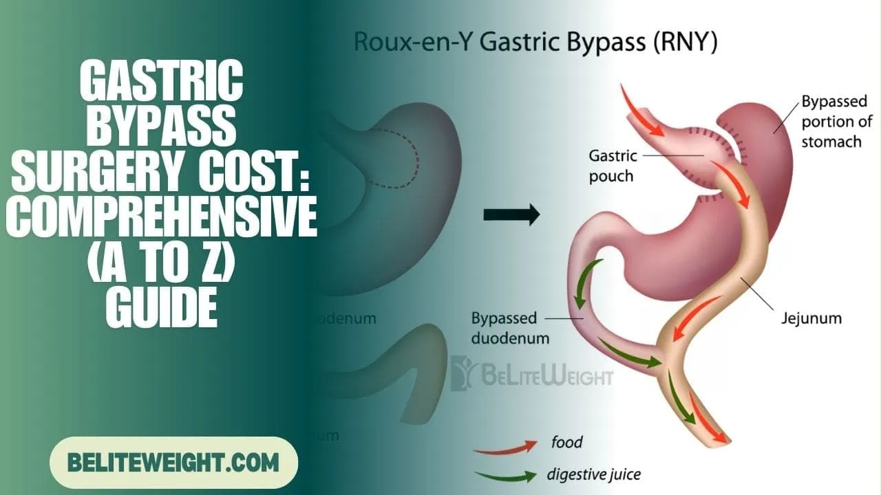 Gastric Bypass Surgery Cost